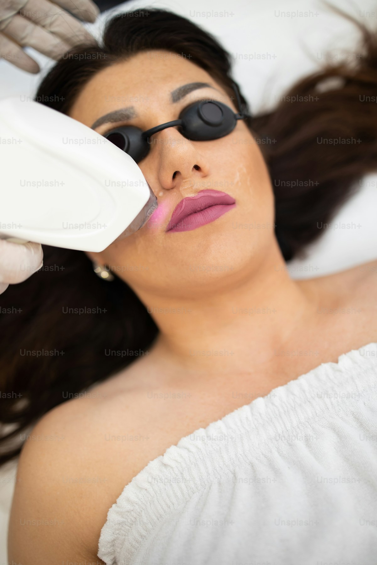 Facial laser hair removal